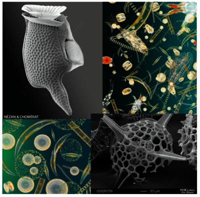 Phytoplankton and zooplankton as seen under the microscope.